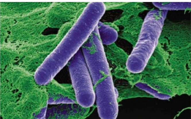 Ngộ độc botulinum: Mối nguy từ vi khuẩn “vô hình” trong thực phẩm và lời cảnh tỉnh từ vụ sữa nhiễm khuẩn- Ảnh 2.