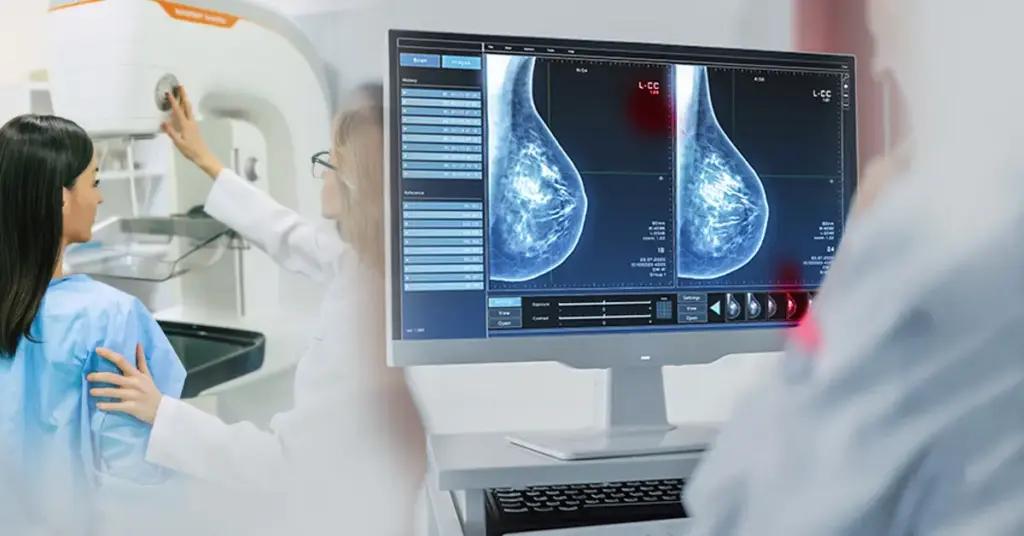 Phát hiện sớm ung thư vú nhờ ứng dụng AI trong chụp nhũ ảnh tầm soát- Ảnh 1.