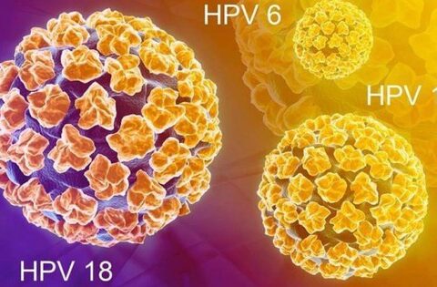 Chủng virus HPV nào dễ gây ung thư cổ tử cung nhất?