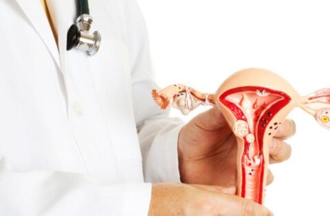 10 nguyên nhân gây nóng rát âm đạo