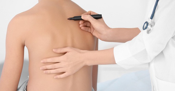 Làm gì khi trẻ gù lưng, cong vẹo cột sống do dùng điện thoại quá nhiều?