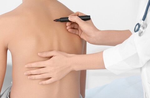 Làm gì khi trẻ gù lưng, cong vẹo cột sống do dùng điện thoại quá nhiều?