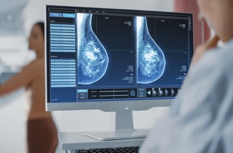 Ai nên chụp nhũ ảnh thường xuyên để phát hiện sớm ung thư vú?