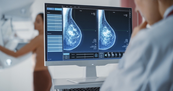 Ai nên chụp nhũ ảnh thường xuyên để phát hiện sớm ung thư vú?