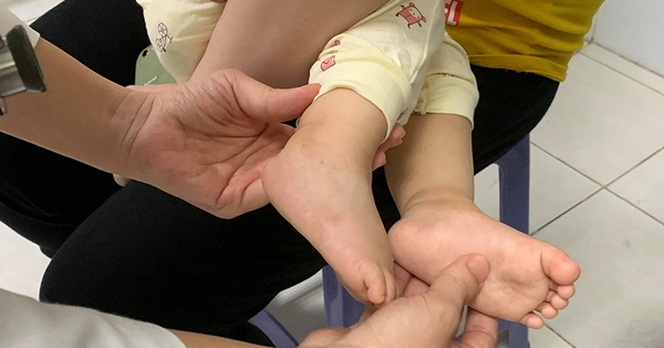 Mắc tay chân miệng độ 4, trẻ nguy kịch, cha mẹ cần chú ý như thế nào?