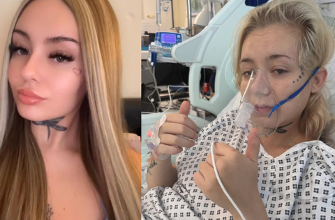 Cô gái 21 tuổi bị ung thư phổi sau 6 năm duy trì 1 sở thích vạn người trẻ mê