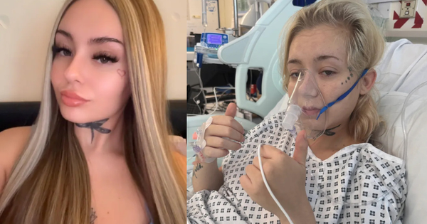 Cô gái 21 tuổi bị ung thư phổi sau 6 năm duy trì 1 sở thích vạn người trẻ mê