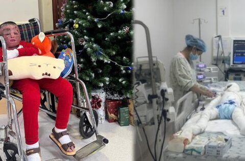 96 ngày giành sự sống của cậu bé 5 tuổi bị cha đốt xăng bỏng đến 80%: “Phép màu từ nghị lực phi thường”