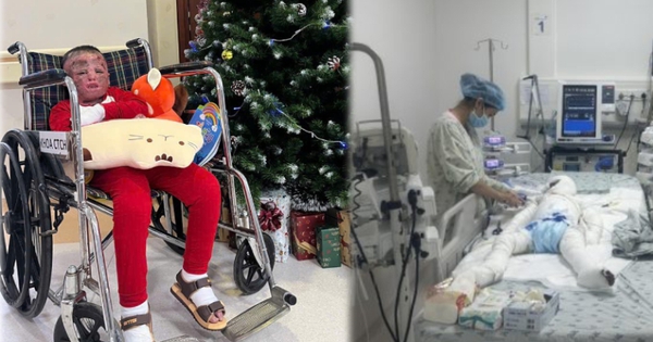 96 ngày giành sự sống của cậu bé 5 tuổi bị cha đốt xăng bỏng đến 80%: “Phép màu từ nghị lực phi thường”