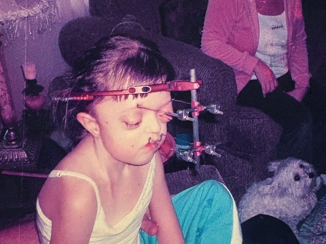 Tôi đã che giấu khuôn mặt suốt nhiều năm, nhưng giờ tôi tự hào chấp nhận vẻ khác biệt của chính mình- Ảnh 3.