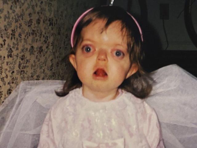 Tôi đã che giấu khuôn mặt suốt nhiều năm, nhưng giờ tôi tự hào chấp nhận vẻ khác biệt của chính mình- Ảnh 2.