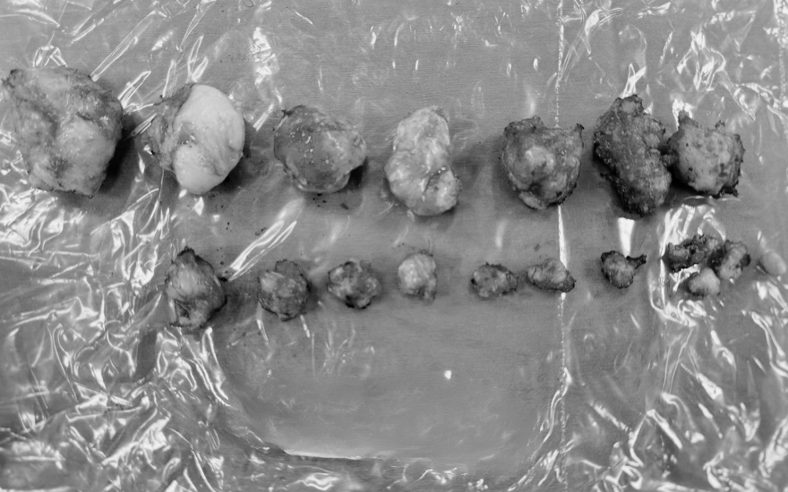 Ảnh 3 - Đã chỉnh theo fb của BBT Ảnh 3 - Đã chỉnh theo fb của BBT