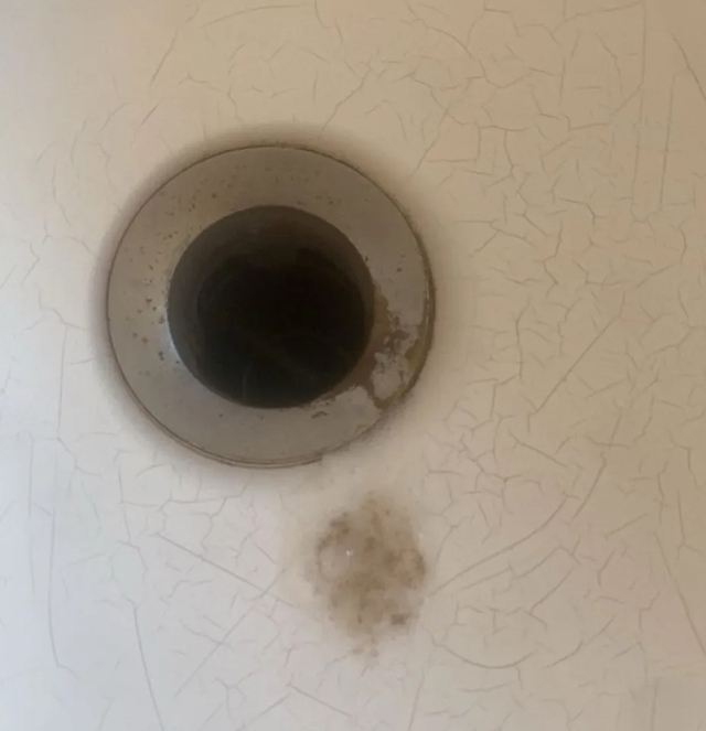 Cô gái 21 tuổi bị ung thư phổi sau 6 năm duy trì 1 sở thích vạn người trẻ mê- Ảnh 3.