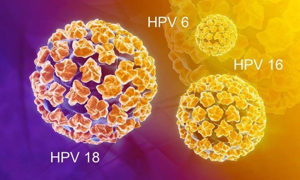Chủng virus HPV nào dễ gây ung thư cổ tử cung nhất?- Ảnh 1. Chủng virus HPV nào dễ gây ung thư cổ tử cung nhất?- Ảnh 1.