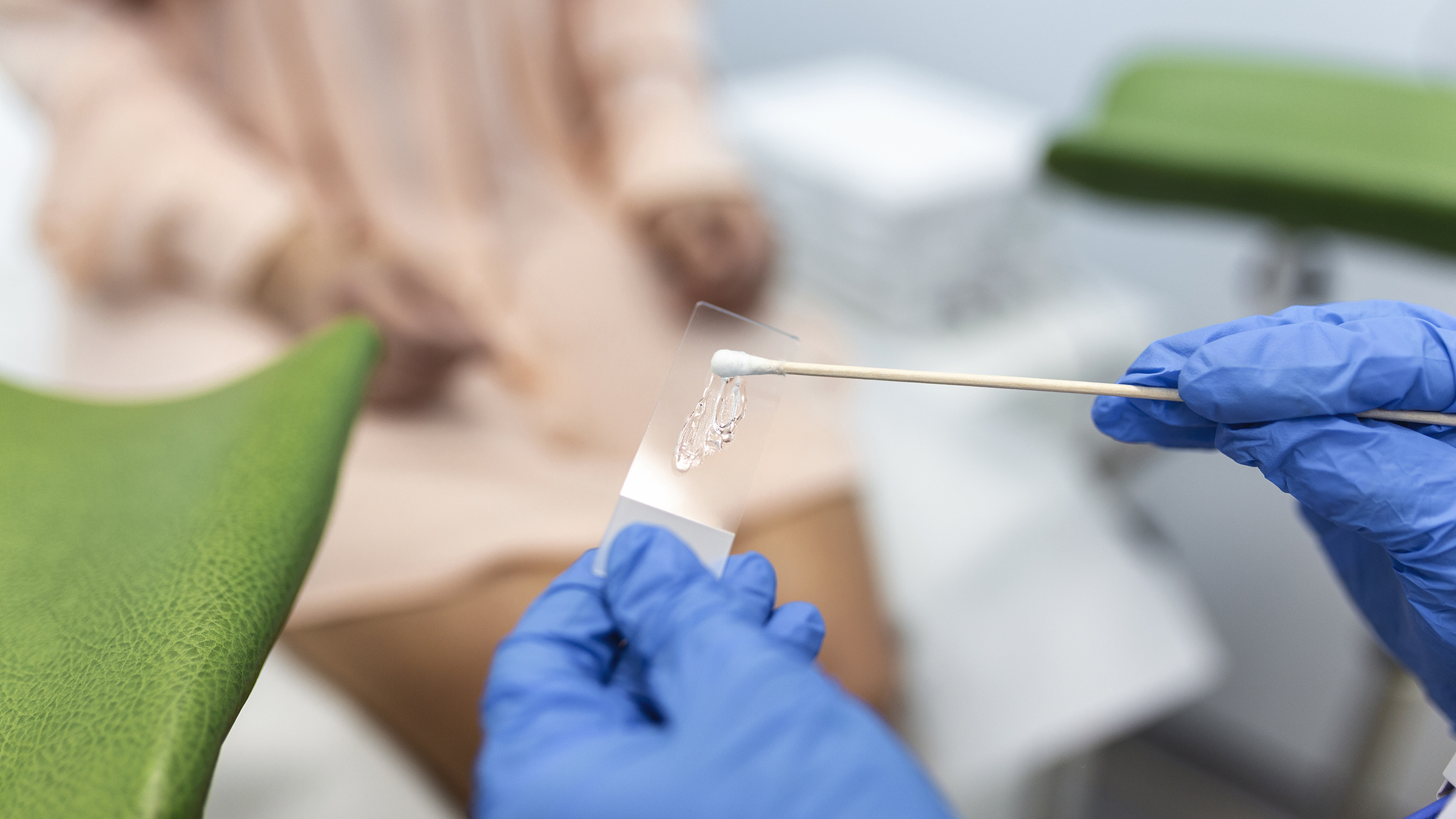 Chủng virus HPV nào dễ gây ung thư cổ tử cung nhất?- Ảnh 3. Chủng virus HPV nào dễ gây ung thư cổ tử cung nhất?- Ảnh 3.