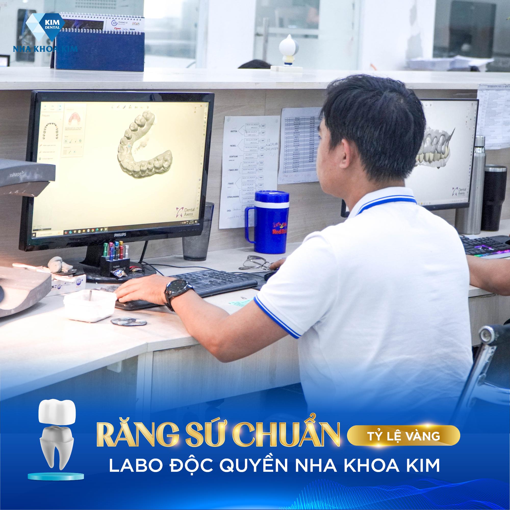 Bí mật sau tấm thẻ bảo hành: Vì sao cùng một chiếc thẻ nhưng chất lượng răng sứ lại… khác nhau?- Ảnh 3. Bí mật sau tấm thẻ bảo hành: Vì sao cùng một chiếc thẻ nhưng chất lượng răng sứ lại… khác nhau?- Ảnh 3.