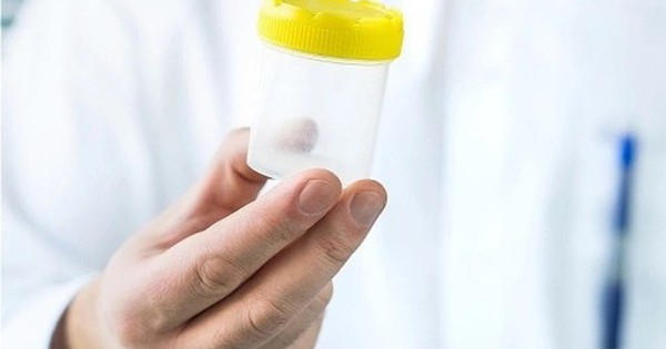 Tinh dịch đổi màu: Dấu hiệu bệnh lý không thể chủ quan