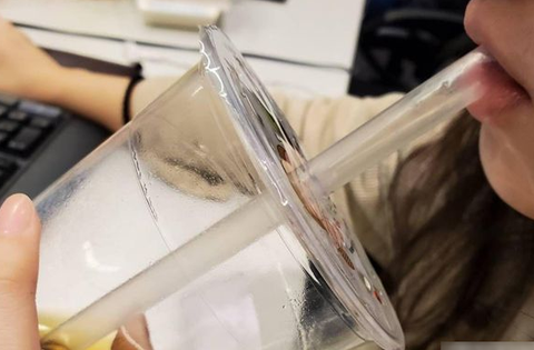 Nữ nhân viên văn phòng suy thận giai đoạn cuối: Trước uống loại nước này 2 lần mỗi ngày, giờ chạy thận 3 lần/tuần