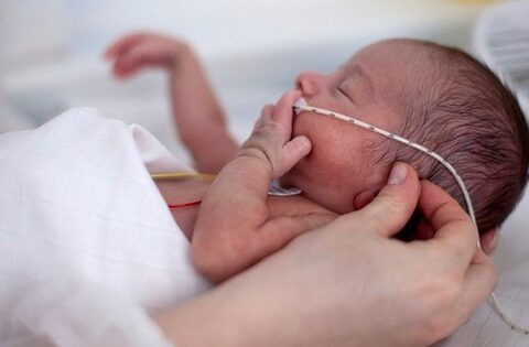 Trí tuệ nhân tạo dự đoán biến chứng sức khỏe ở trẻ sinh non