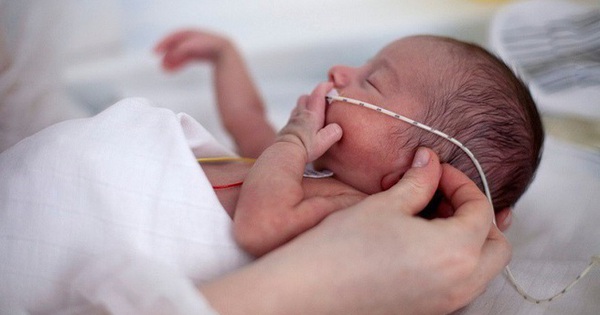 Trí tuệ nhân tạo dự đoán biến chứng sức khỏe ở trẻ sinh non