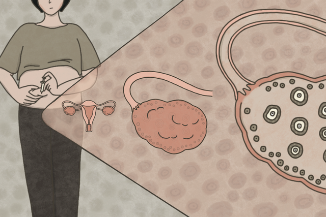 Phụ nữ cả đời chỉ có 400 quả trứng? Sự thật về chuyện Phụ nữ cả đời chỉ có 400 quả trứng? Sự thật về chuyện