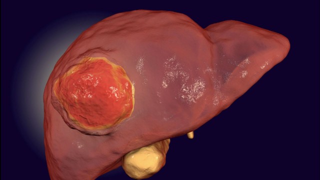 Bác sĩ chỉ ra 5 thói quen ăn uống nuôi Bác sĩ chỉ ra 5 thói quen ăn uống nuôi
