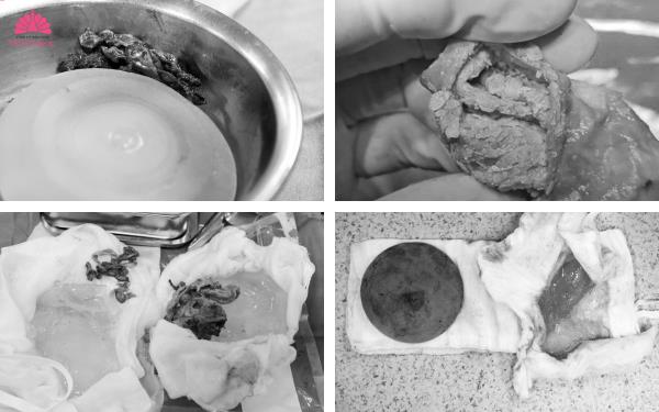 Sở hữu vòng 1 đẹp an toàn với xu hướng nâng ngực 4 không- Ảnh 1. Sở hữu vòng 1 đẹp an toàn với xu hướng nâng ngực 4 không- Ảnh 1.