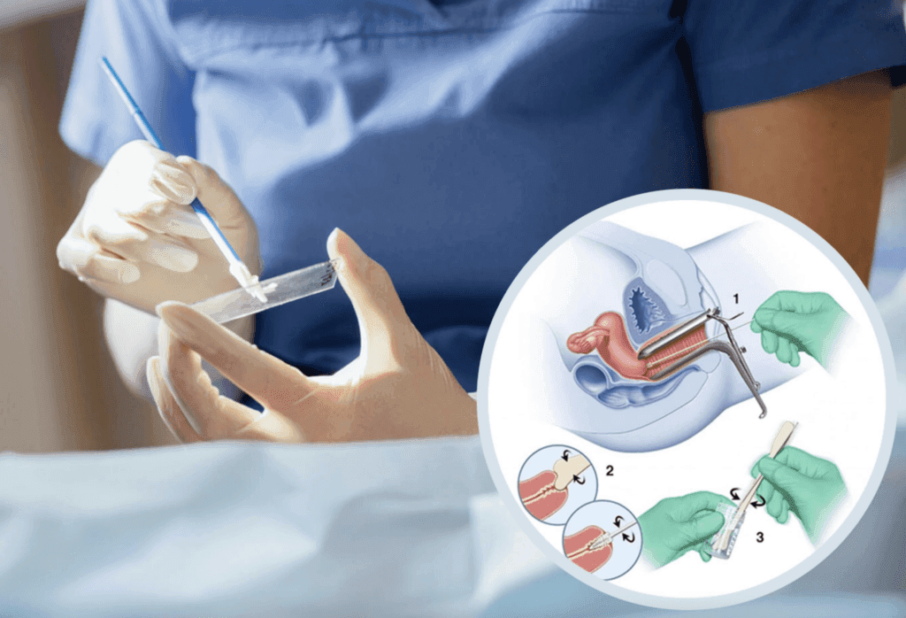 Khi nào nên làm xét nghiệm Pap để sàng lọc ung thư cổ tử cung?- Ảnh 1.