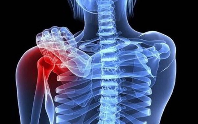 Cơn ho tưởng vô hại của cậu bé 15 tuổi và chẩn đoán khiến cả gia đình sụp đổ- Ảnh 4. Cơn ho tưởng vô hại của cậu bé 15 tuổi và chẩn đoán khiến cả gia đình sụp đổ- Ảnh 4.