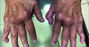 Nóng: Loại virus “phá hủy nội tạng” có thể chuẩn bị bùng phát