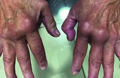 Nóng: Loại virus “phá hủy nội tạng” có thể chuẩn bị bùng phát