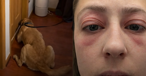 Bỏ 10 tỷ mua nhà, dọn vào ở được vài tháng, người phụ nữ mắc phải căn bệnh lạ khiến cơ thể biến dạng