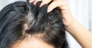 Liệu người tóc bạc ít khả năng mắc ung thư hơn? Có bằng chứng khoa học nào không? Câu trả lời đã có ở đây