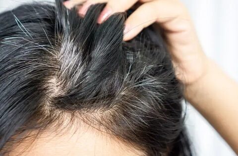 Liệu người tóc bạc ít khả năng mắc ung thư hơn? Có bằng chứng khoa học nào không? Câu trả lời đã có ở đây