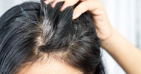 Liệu người tóc bạc ít khả năng mắc ung thư hơn? Có bằng chứng khoa học nào không? Câu trả lời đã có ở đây