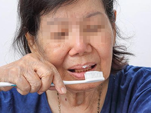 Người phụ nữ 50 tuổi nhất quyết đánh răng bằng nước muối pha loãng, 1 năm sau kết quả gây chấn động- Ảnh 1. Người phụ nữ 50 tuổi nhất quyết đánh răng bằng nước muối pha loãng, 1 năm sau kết quả gây chấn động- Ảnh 1.