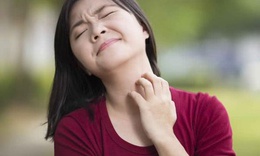 Ngứa do lạnh có nguy hiểm không?
