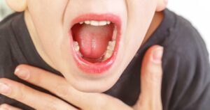 Ngoài dấu hiệu sốt khi viêm amidan ở trẻ có thêm biểu hiện gì?