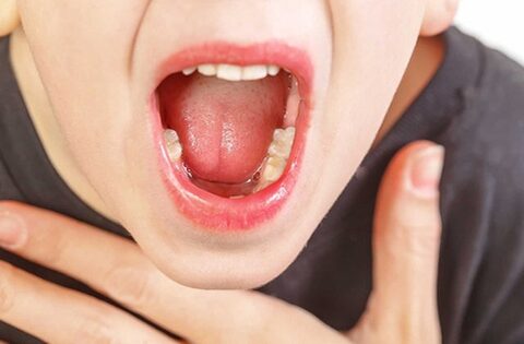 Ngoài dấu hiệu sốt khi viêm amidan ở trẻ có thêm biểu hiện gì?