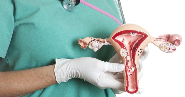 Viêm cổ tử cung: những biến chứng đe dọa sức khỏe sinh sản và cách điều trị