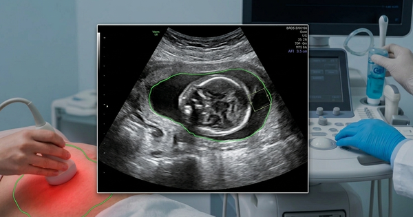 Nước ối ít và biến chứng thai kỳ: ‘Cảnh báo đỏ’ mẹ bầu cần lưu tâm