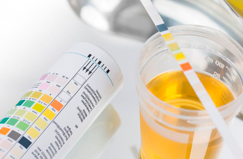 Làm thế nào để nhận biết trẻ bị rối loạn đi tiểu?