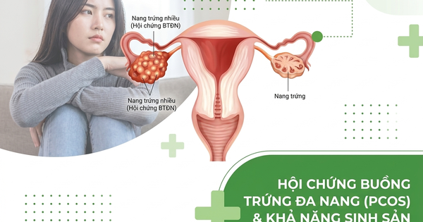 4 cách cải thiện khả năng sinh sản khi bị Hội chứng buồng trứng đa nang
