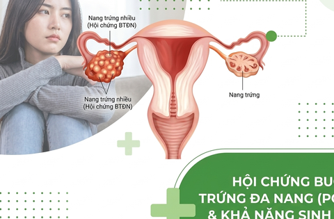4 cách cải thiện khả năng sinh sản khi bị Hội chứng buồng trứng đa nang