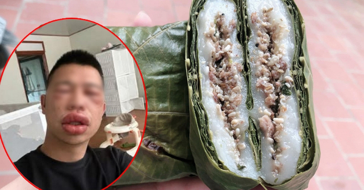 Tết Thanh Minh rủ nhau ăn bánh trứng kiến: Người khen “nổ bôm bốp vui miệng”, người thì… “đổi luôn giao diện” vì dị ứng