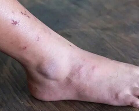 Khi ung thư mới bắt đầu hình thành, người ta thường cảm thấy 3 điều không ổn, nhưng ít ai chú ý đến