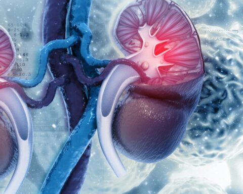 Thận xuống cấp nhanh chóng nếu ăn quá nhiều 9 loại thực phẩm này: Toàn món khoái khẩu của nhiều người