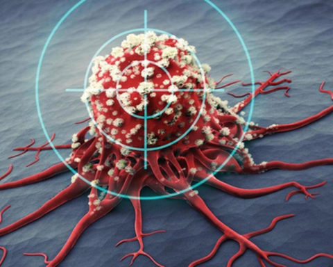 Dấu hiệu cảnh báo ung thư trước 1 năm