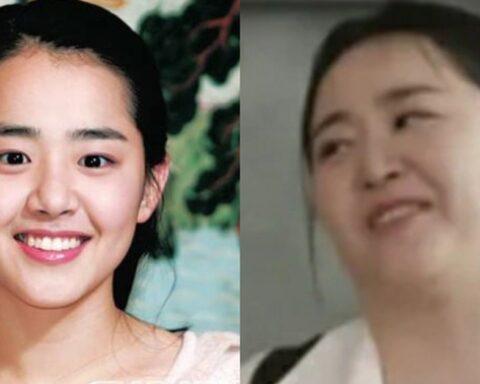 Moon Geun Young bị hoại tử và phát tướng mất kiểm soát do bệnh quái ác, bỏ lỡ giai đoạn vàng để điều trị