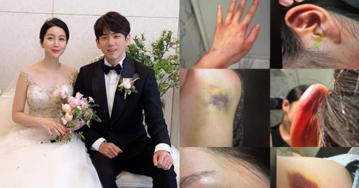 Anh trai Jisoo (BLACKPINK) lại trở thành tâm điểm phẫn nộ: Bị tố bạo hành gia đình, bắt vợ phải quỳ gối xin tha?